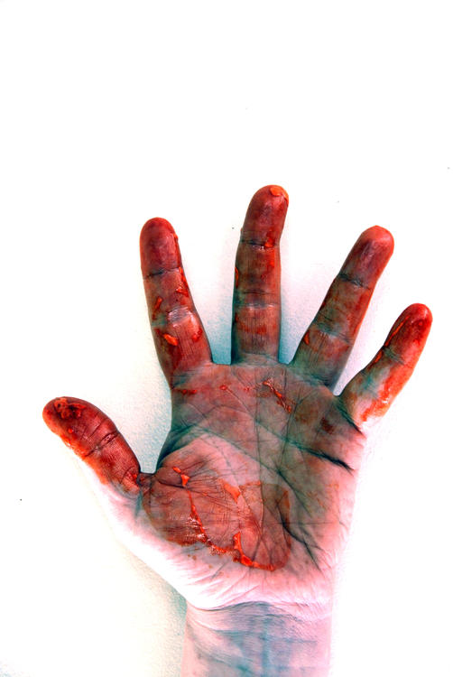 Bloody Hand